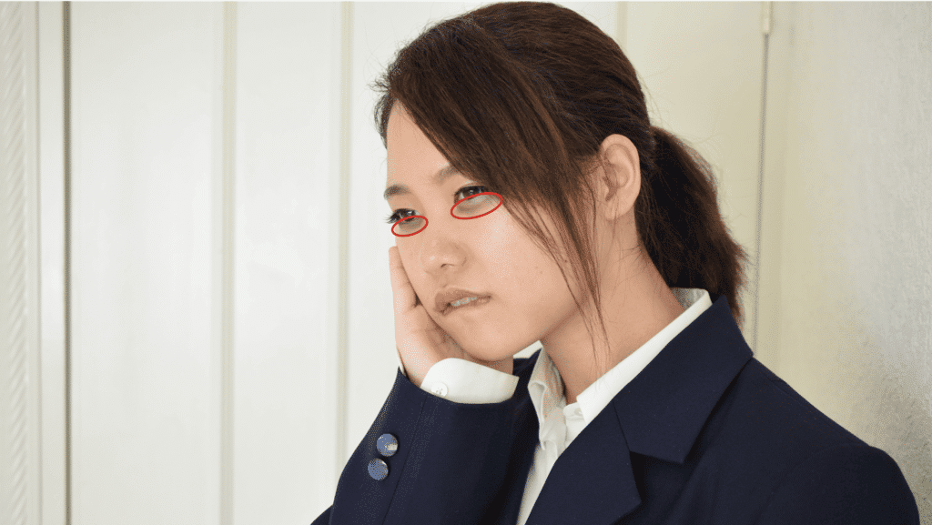 クマのある女性